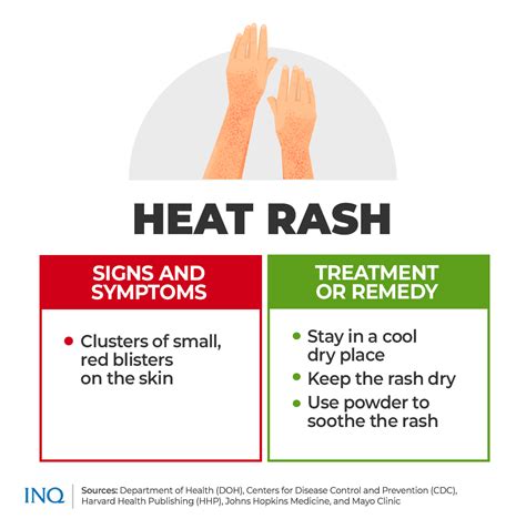 EXPLAINER: Prevent heat exhaustion, heat stroke, other related illness ...