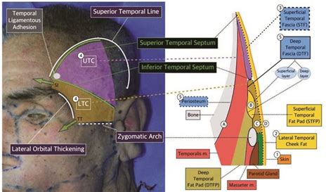 Pin on Surgical neuroanatomy