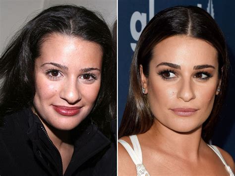 Lea Michele, Before and After | Beauty, Rhinoplasty nose jobs ...