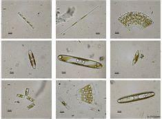 8 Pond Water under the Microscope ideas | protists, single-celled ...