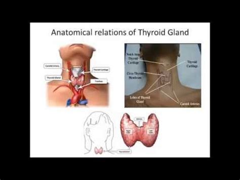 Thyroid Fine Needle Aspiration (TFNA) - YouTube