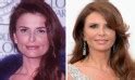 Roma Downey Facelift Plastic Surgery Before and After | Celebie