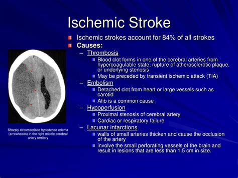 PPT - Neuroradiology for Medical Students PowerPoint Presentation, free ...