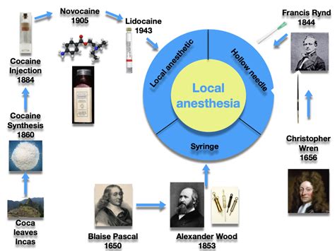 History of Dental Anesthesia - History of Dentistry And Medicine | The Illustrated Encyclopedia ...