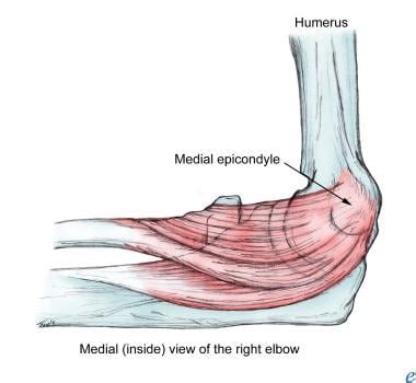 Surgery for Medial Epicondylitis: Background, Anatomy, Pathophysiology