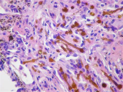 Asbestos - Phase Contrast Microscope