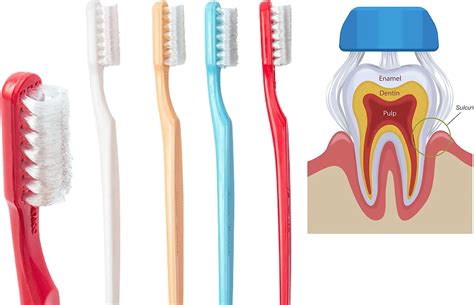 Collis Curve - Soft 3 Sided Toothbrush - Orthodontic Toothbrushes ...