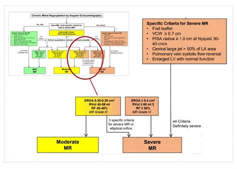 Grading MR Severity with Echo echo MR grading severity Cardioserv