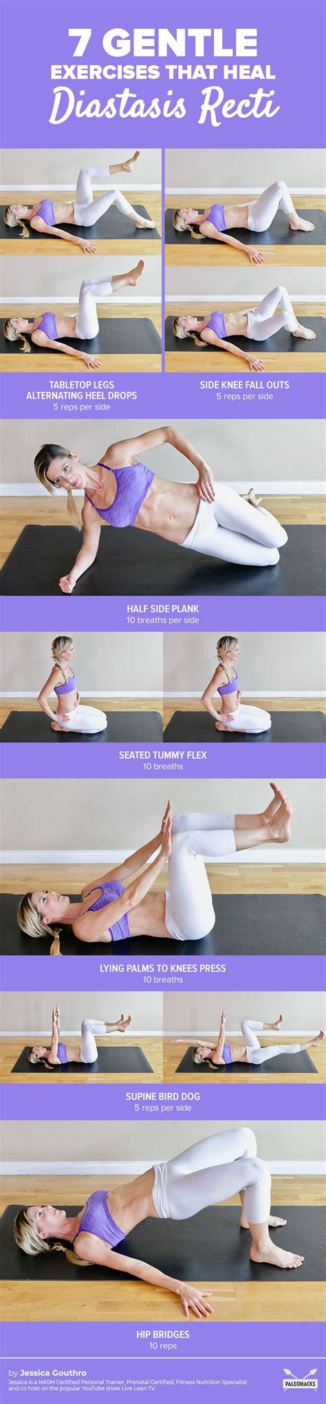 Diastasis Recti Exercises Program | EOUA Blog