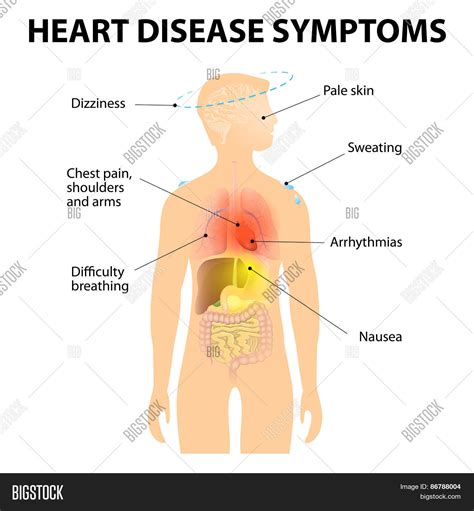 Heart Disease Vector & Photo (Free Trial) | Bigstock