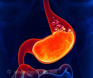 Acid Peptic Disease - Causes Symptoms Complications Diagnosis Treatment