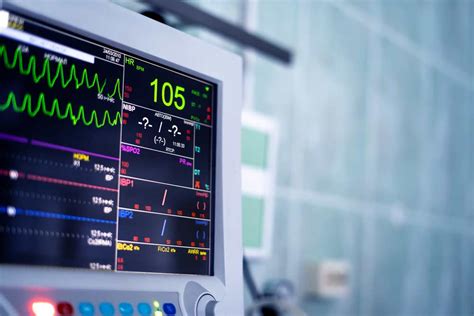 Electrocardiogram (ECG) - HOSPITALS MAGAZINE