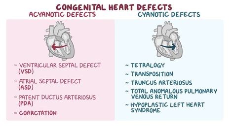 Congenital Defects Tutorial Congenital Heart Defects