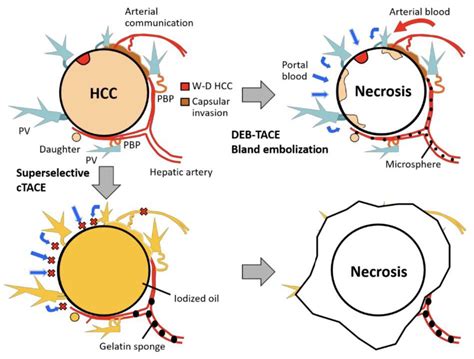 Livers | Free Full-Text | An Updated Review on Advances in Hydrogel-Based Nanoparticles for ...