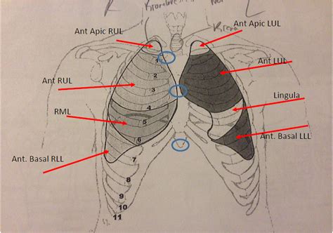 Lung Auscultation