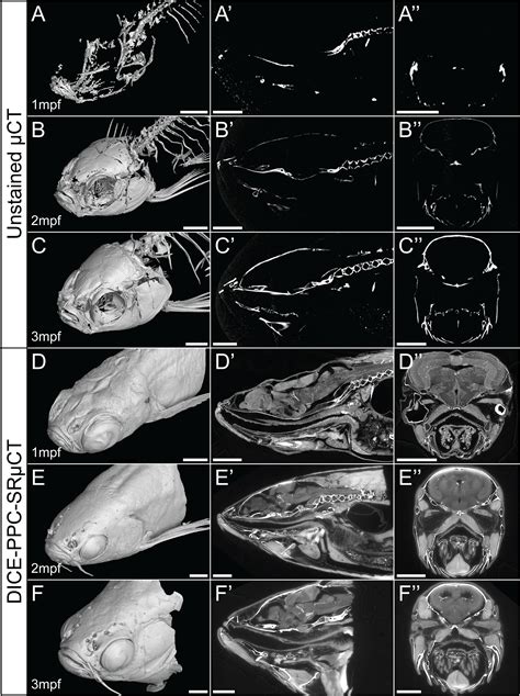 Frontiers | Enhanced contrast synchrotron X-ray microtomography for describing skeleton ...