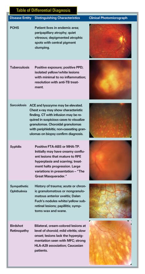 Multifocal Choroiditis vs. PIC: Variations on a Theme?