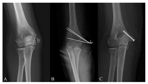 Diagnostics | Free Full-Text | Is Computed Tomography Necessary for Diagnostic Workup in ...