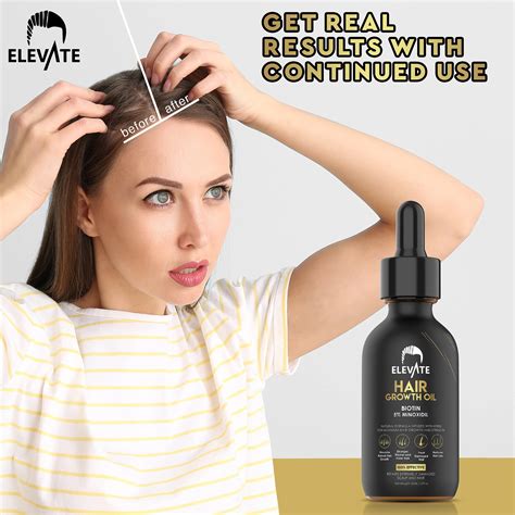 ELEVATE Hair Growth Oil - Biotin Hair Growth Serum & 5% Minoxidil ...