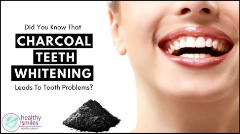 Side Effects Of Charcoal Teeth Whitening - Teeth Poster