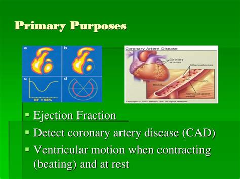 PPT - What is a MUGA scan? PowerPoint Presentation, free download - ID ...