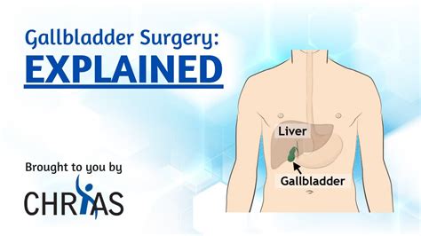 Gallbladder Surgery: Explained - YouTube