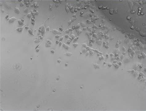 Why some cells were not stained with Hoechst 33258?