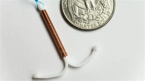 Exploring the Risk of IUD Expulsion