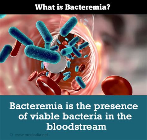 Bacteremia - Causes, Symptoms, Diagnosis, Treatment, Prevention