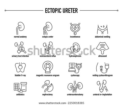 Ectopic Ureter Symptoms Diagnostic Treatment Icon Stock Vector (Royalty ...