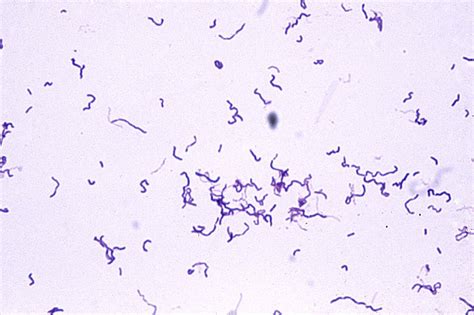 Gram-Positive Bacilli (Rods) - Microbiology learning: The "why"ology of microbial testing