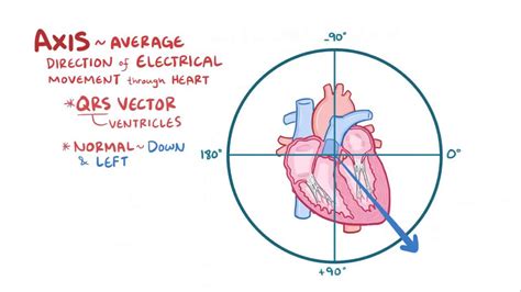 Ekg Axis