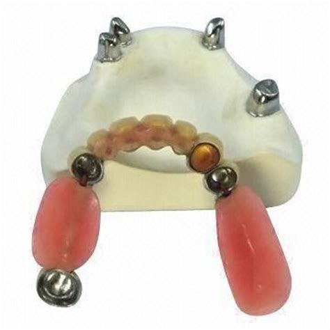 Telescope Denture Zirconium Alumina Valplas shenzhen - WorldBid B2B Market