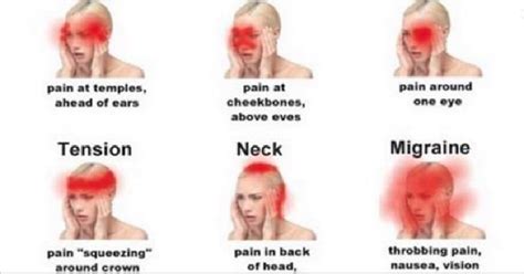 The Place Of The Pain Detects The Type Of Headache, The Cause And Permanent Solution! - Holistic ...