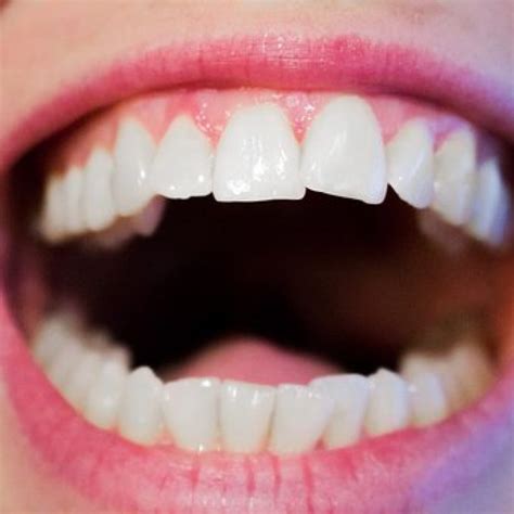 Tips for Healthy Teeth and Gums | Simcoe Smile Dental