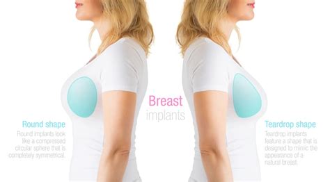 Why Breast Surgery Patients Should Consider Teardrop Implants | Health Source Magazine