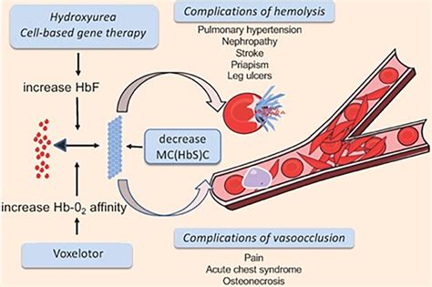 Pathophysiology and HbS polymerization. HbS polymerization (left)... | Download Scientific Diagram