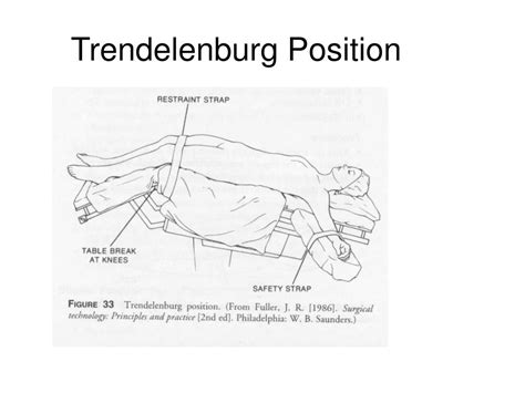 Trendelenburg Position Drawing