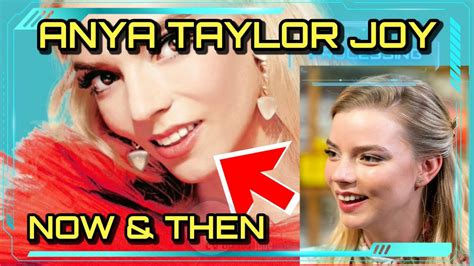 Anya Taylor Joy teeth then and now: before and after surgery tooth ...