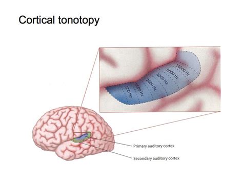 Primary Auditory Cortex