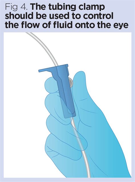 Procedure for eye irrigation to treat ocular chemical injury | Nursing ...