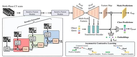 LIDIA: Precise Liver Tumor Diagnosis on Multi-Phase Contrast-Enhanced ...