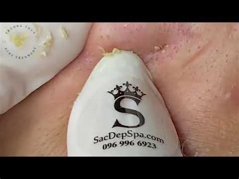 Satisfying Relaxing with Sac Dep Spa Video #101 - YouTube