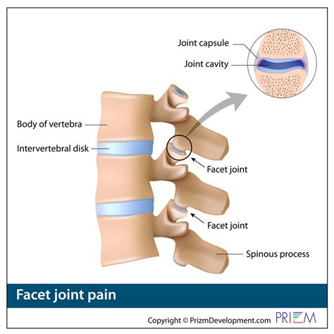 Inferior Articular Facet