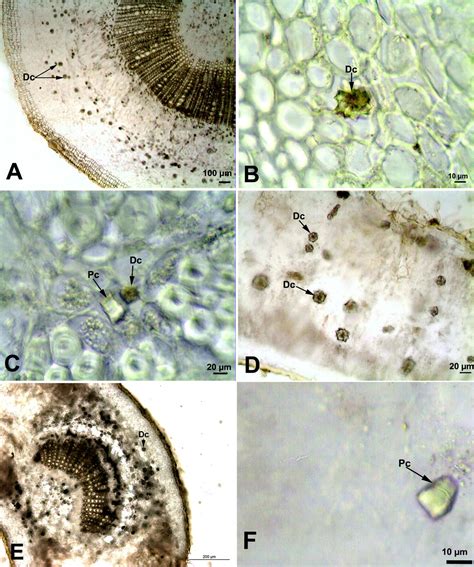 Occurrence, types and distribution of calcium oxalate crystals in leaves and stems of some ...