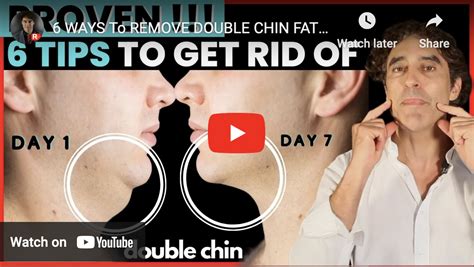 6 WAYS To REMOVE DOUBLE CHIN FAT // Double Chin - Style Aesthetics by RajaniMD