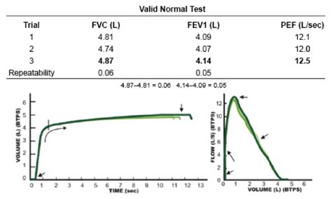 Spirometry - Module