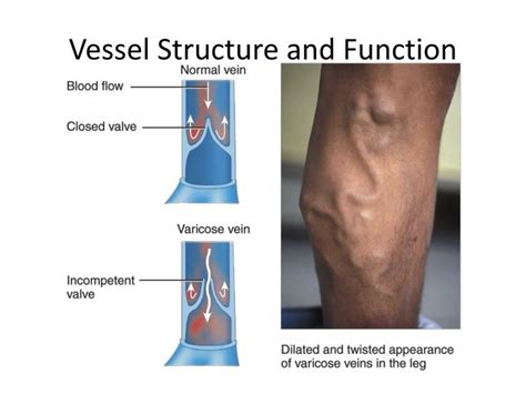 PPT - Vessel Structure and Function PowerPoint Presentation - ID:2179433