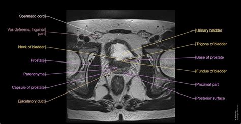 The male pelvis: normal anatomy | e-Anatomy