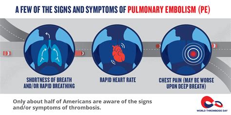 World Thrombosis Day | Pulmonary Embolism